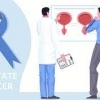 Imagem Câncer de Próstata